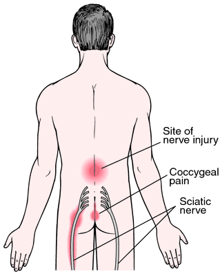 Diagram Of Sciatic Nerve Pathway