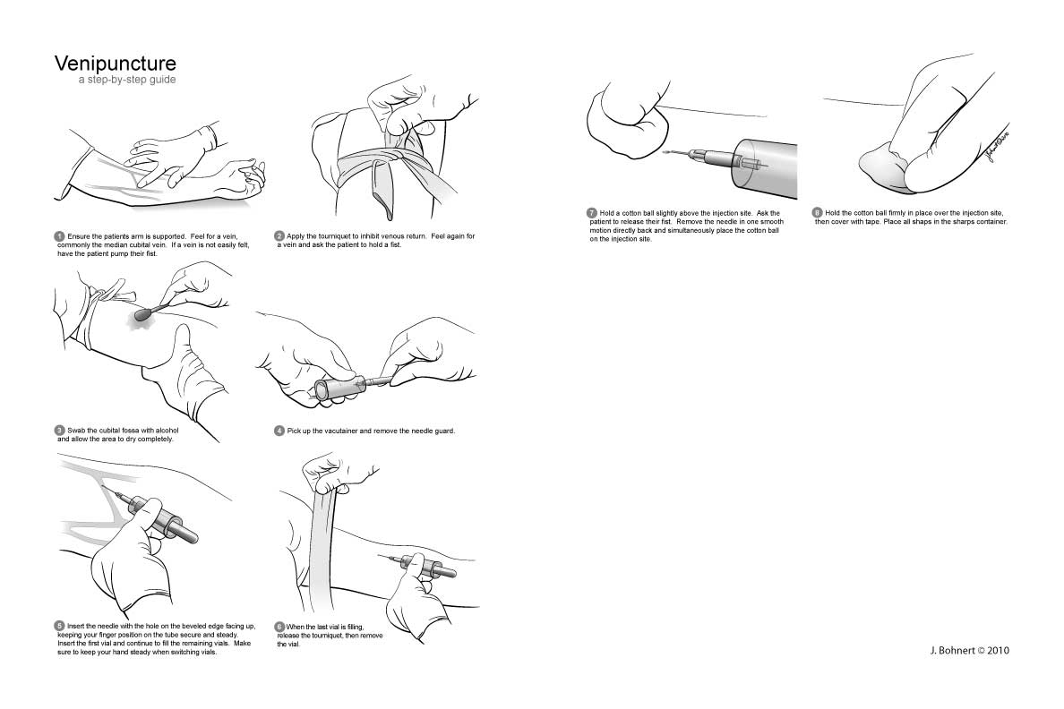 Venipuncture Sites Diagram