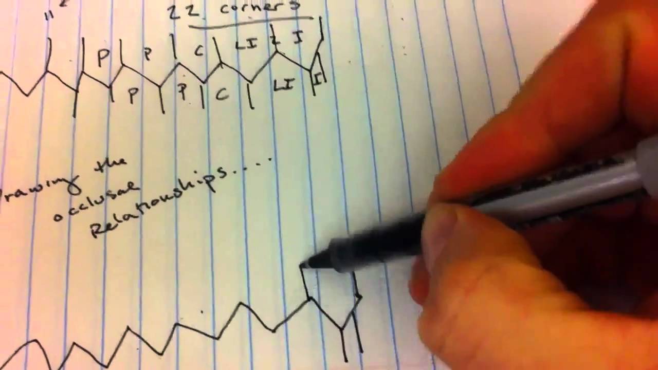 Picket Definition Quizlet at Paula Dayton blog