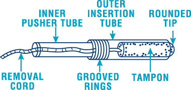 Where To Insert A Tampon Diagram Where To Insert A Tampon Diagram