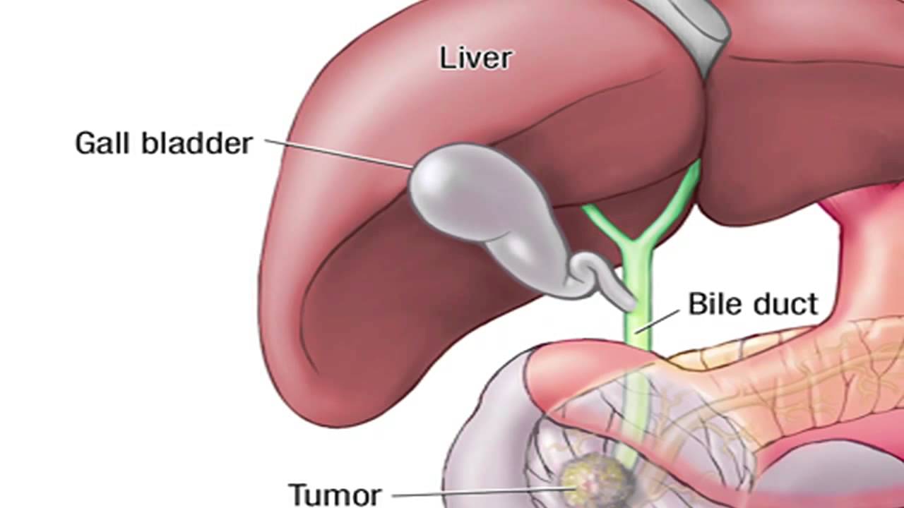 whipple-procedure-diagram