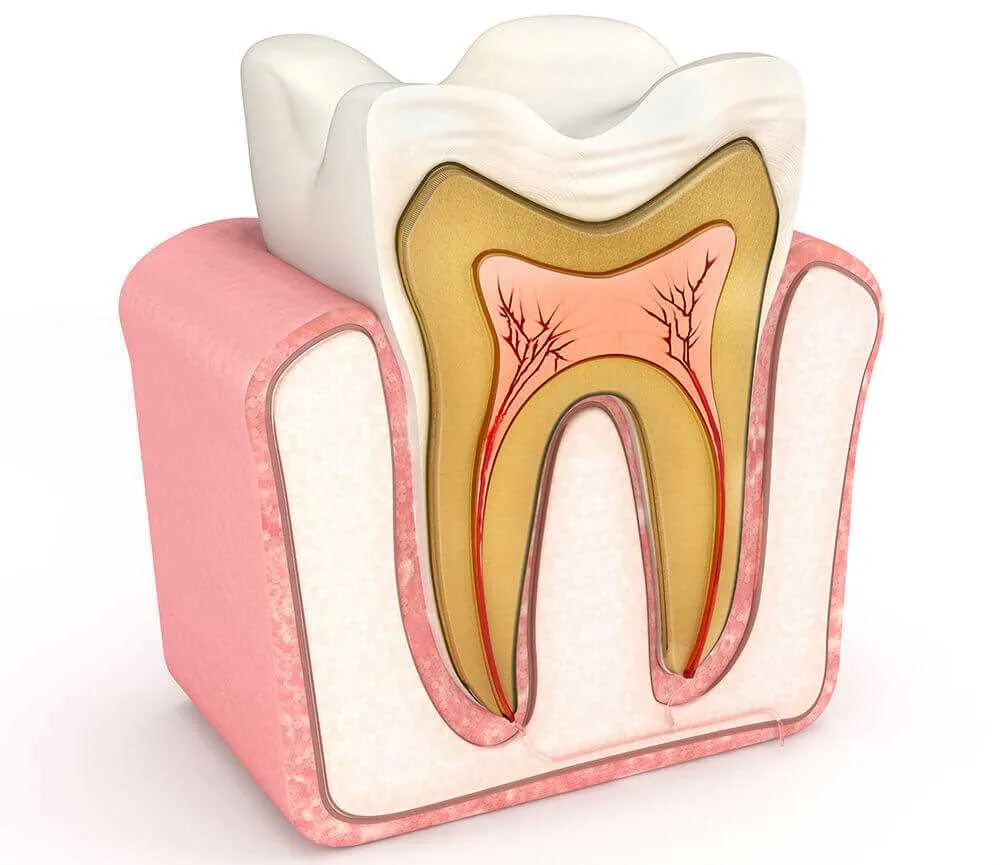 impacted wisdom teeth diagram