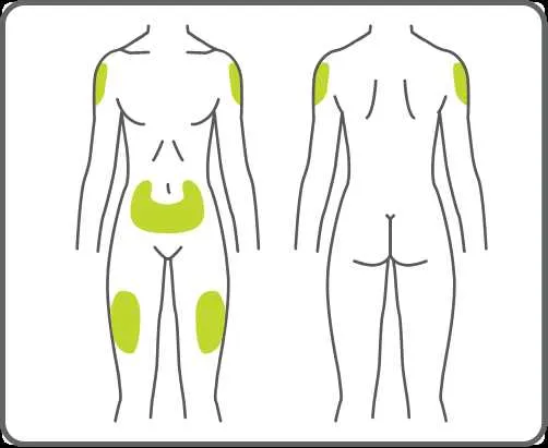 insulin injection sites diagram printable